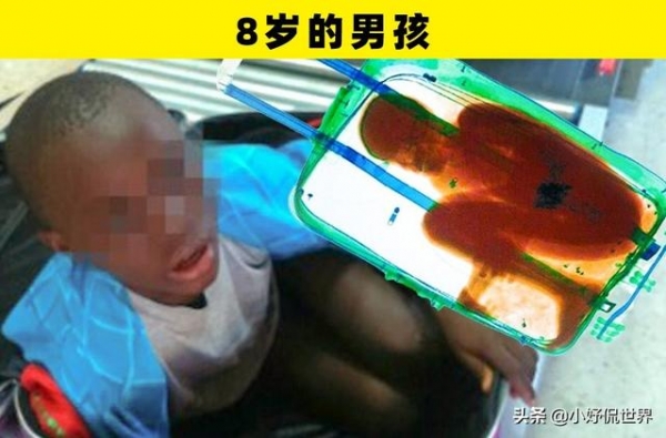 在世界各地的机场和海关安检时，被找到的7件奇怪的东西-4.jpg